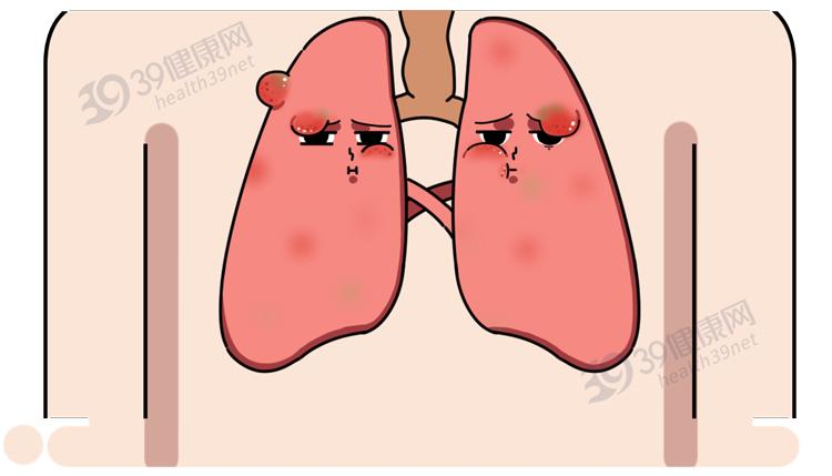 风寒、风热感冒分不清？一文教你区别，原来以前学的都错了  -图6